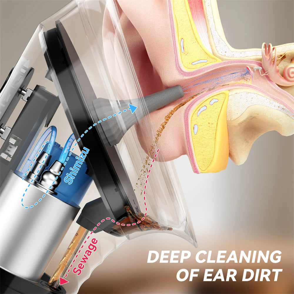 Upgraded Ear Wax Removal with Waste Water Tank Safety Ear Cleaner with Water Temperature Sensor Effective Ear Irrigation Kit