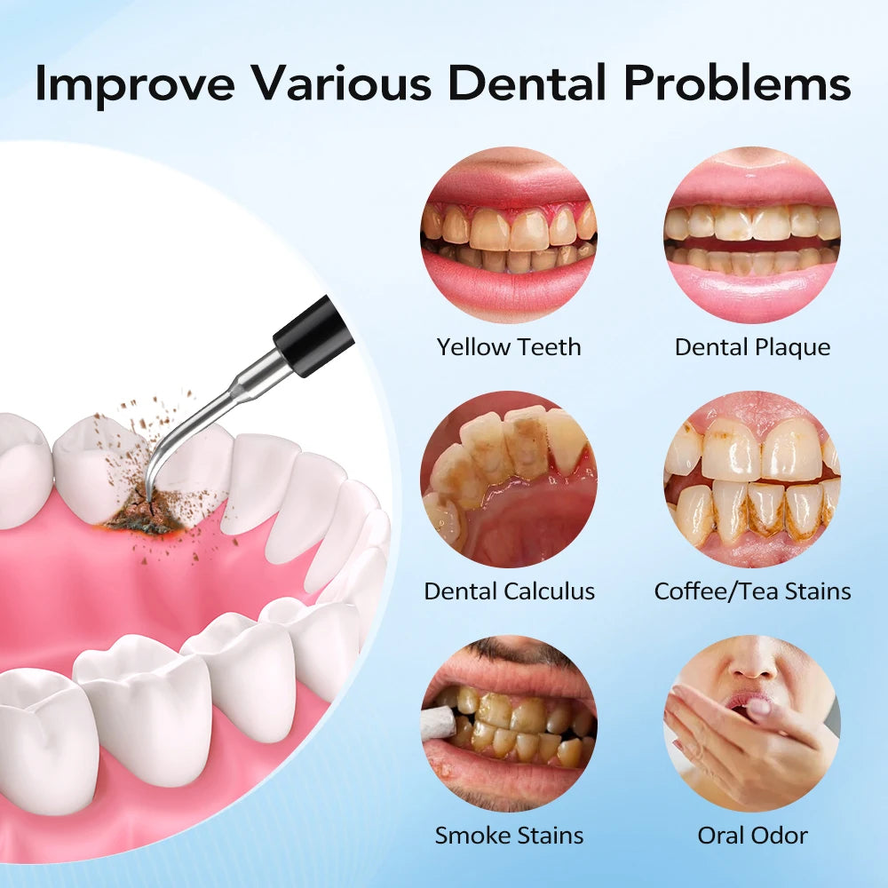 Electric Dental Scaler with Teeth Brush Head Calculus Tartar Remover Vibration Teeth Plaque Cleaner Oral Care Improve Odor